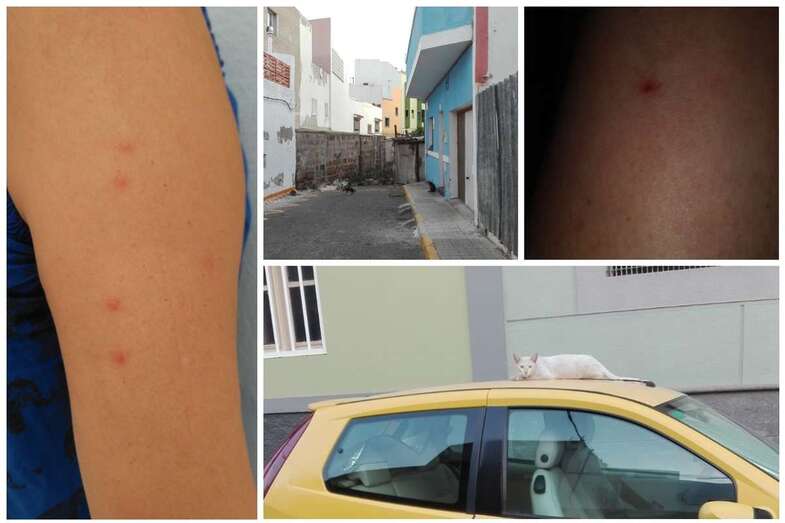 Calle de Víctor Hugo y picaduras en el brazo de una vecina (Foto TA)
